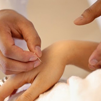 Traditional Chinese Acupuncture
